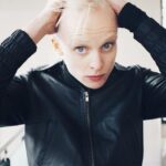 "Gretchen Miranda Revela Luta Contra Alopecia e Desafia Padrões de Beleza nas Redes Sociais"