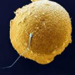 5eg4225df8346c6d2i6 sperm