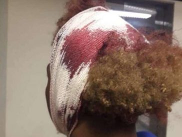 In Rio de Janeiro werden Jugendliche angegriffen