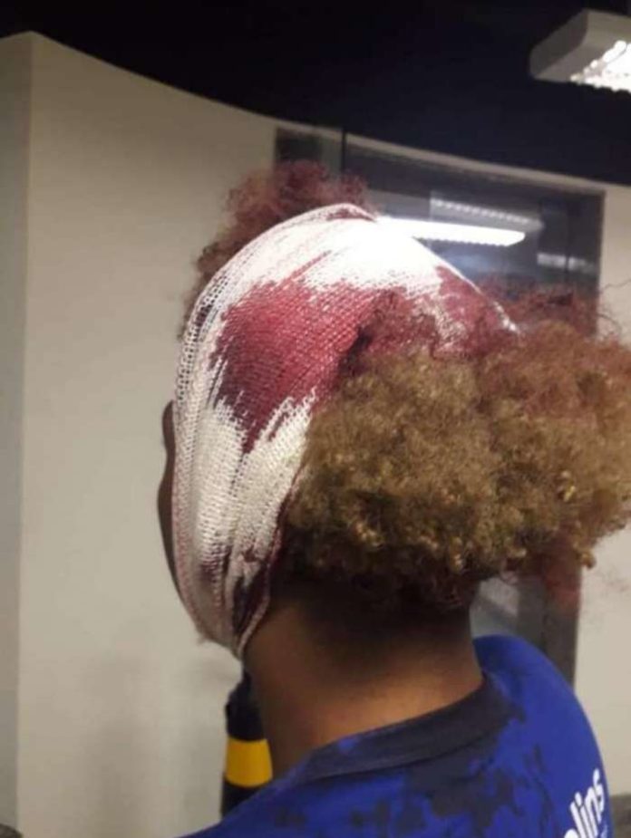 In Rio de Janeiro werden Jugendliche angegriffen