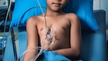 "Frenectomia em Crianças: O Que Esperar do Procedimento e Seus Impactos no Desenvolvimento de Ravi, Filho de Viih Tube"