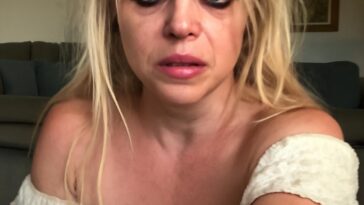 Cantora compartilha imagens com bandagens e hematomas, gerando comoção na comunidade LGBTQIA+