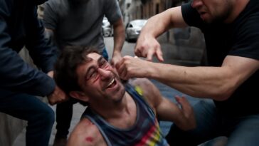 Agressão violenta revela o preconceito ainda presente e a luta por respeito na comunidade LGBTQIA+