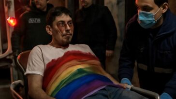 Homem é brutalmente apunhalado por sua orientação sexual em Los Andes, Chile, e luta pela recuperação