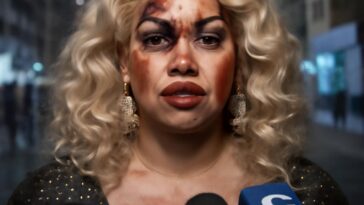 Artista drag relata agressão violenta por ser gay e recebe apoio da comunidade LGBTQIA+