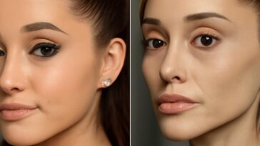 Mudanças no rosto da cantora reacendem debates sobre saúde, estética e pressão midiática