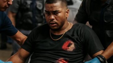 Artista é atingido nas costas após ataque a tiros e passa por cirurgia em hospital