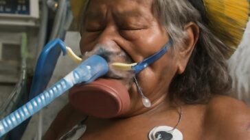 Ícone da luta indígena enfrenta pneumonia e recebe cuidados intensivos em Mato Grosso